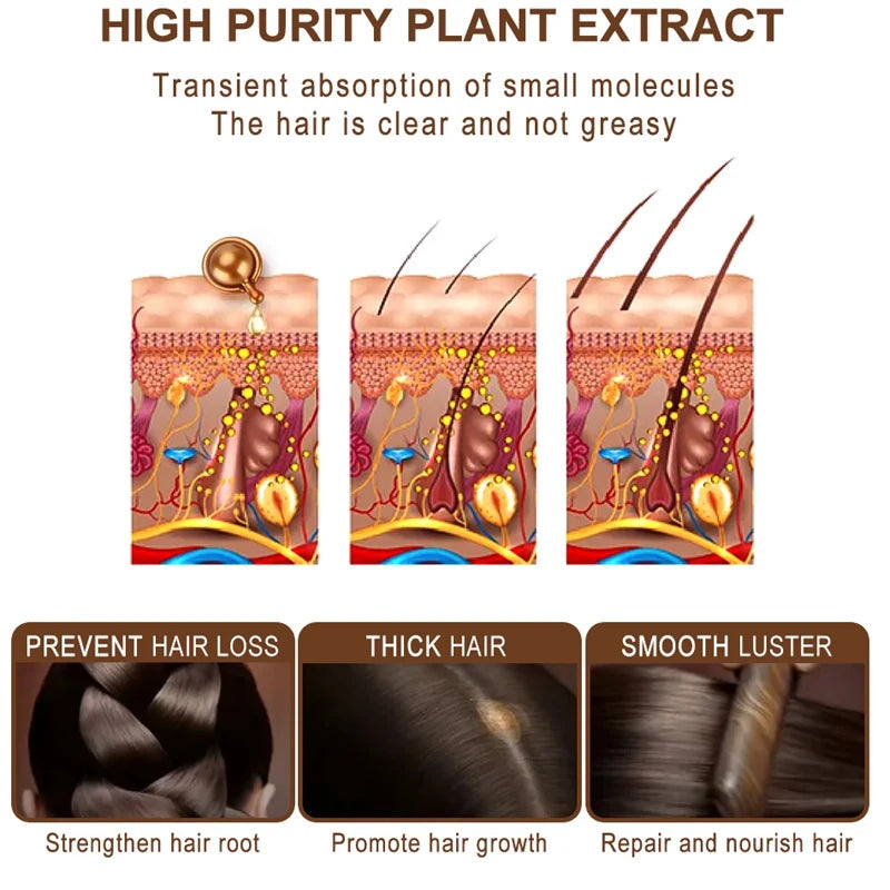 Sevich 30Pcs/bottle Ginger Anti-Hair Loss Capsules