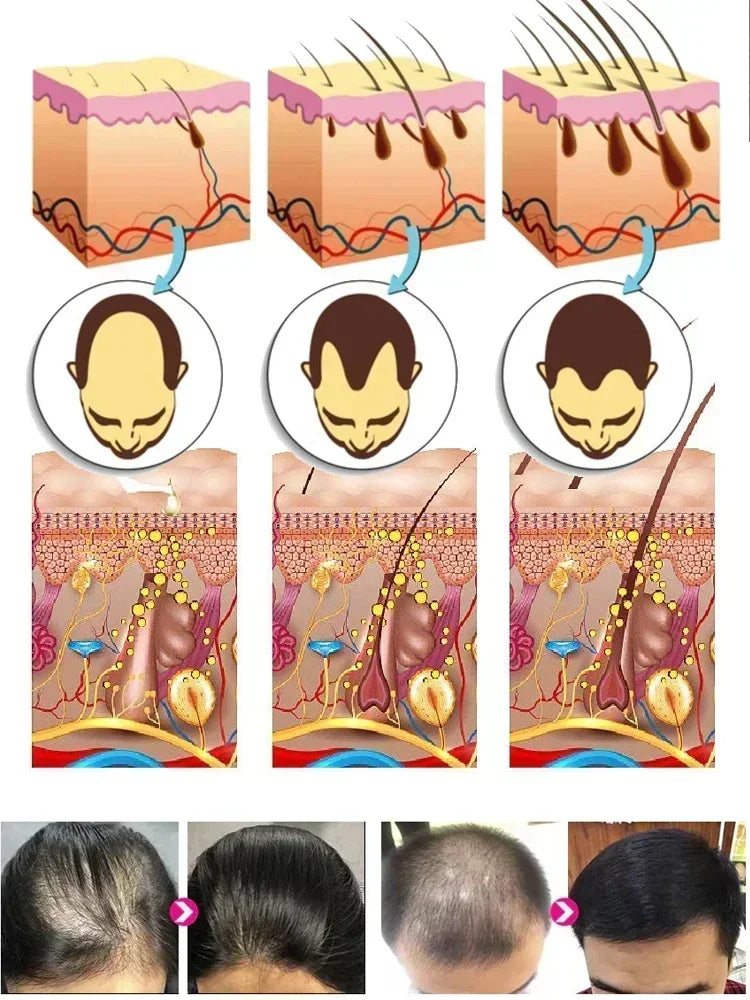 Anti Hair Loss Serum Rapid Hair Growth