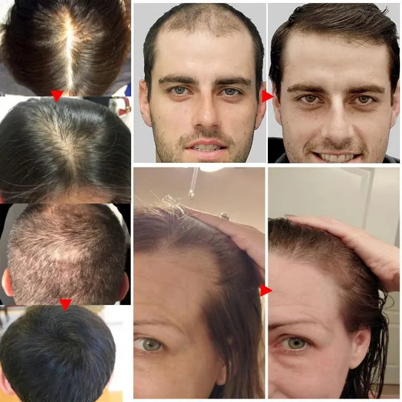Fast Ginger Hair Growth Serum