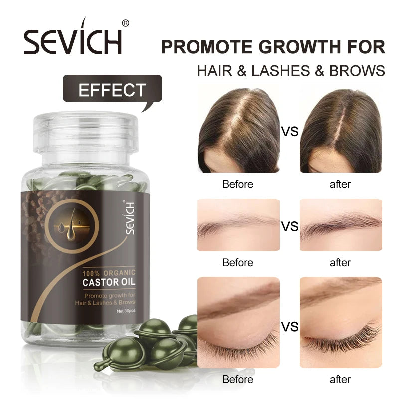 Sevich 30Pcs/bottle Ginger Anti-Hair Loss Capsules