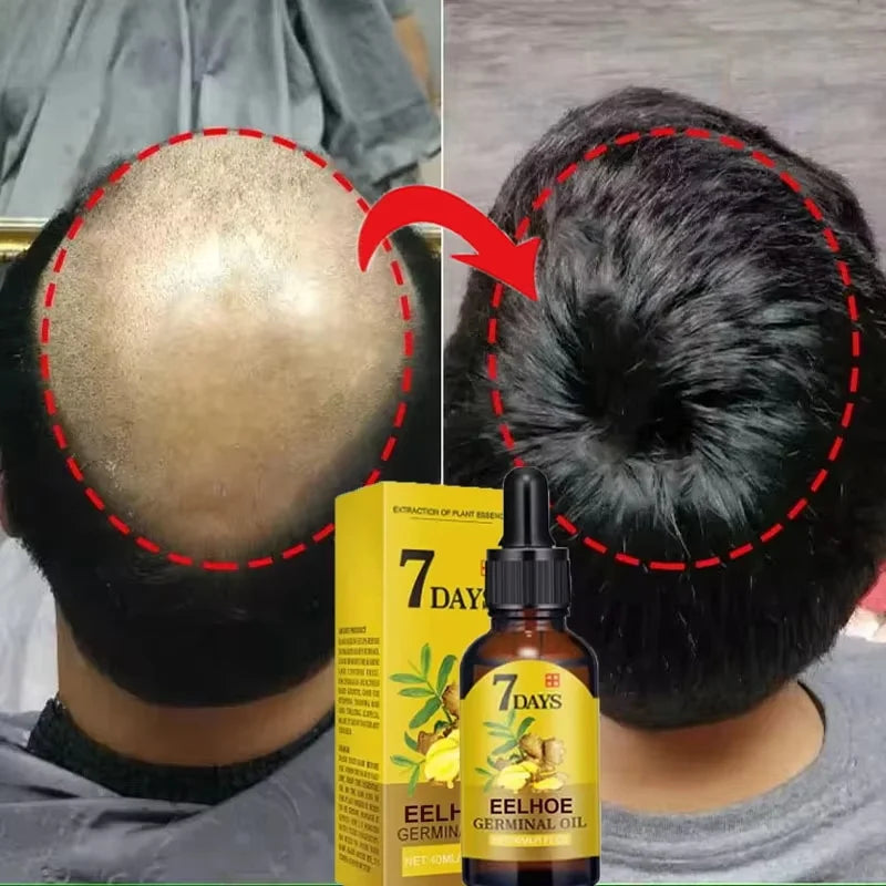 Fast Ginger Hair Growth Serum