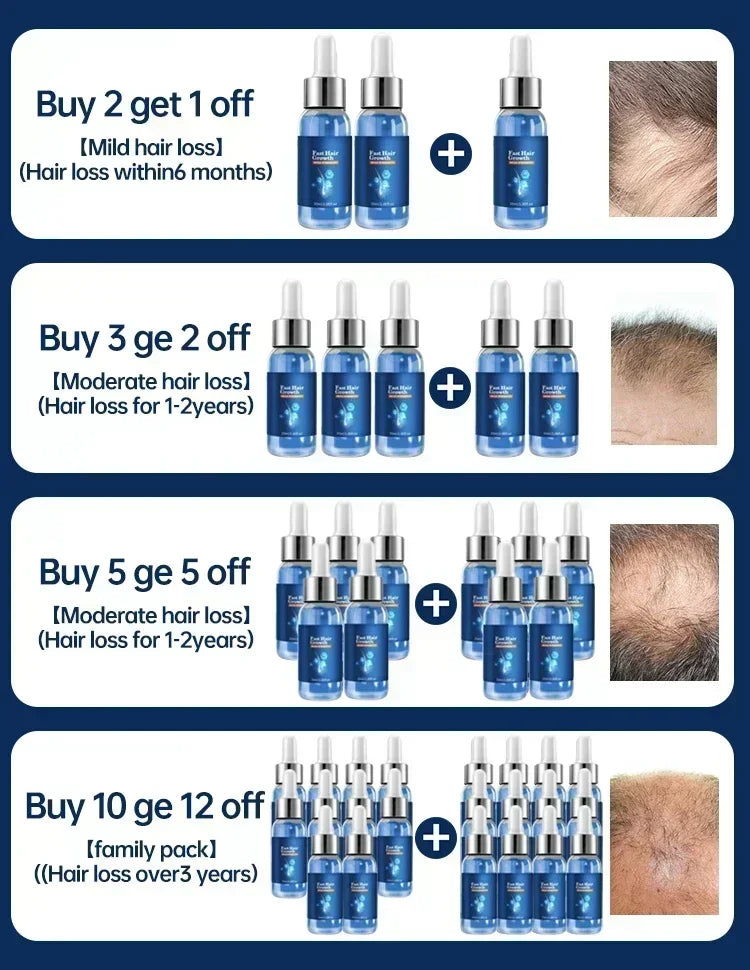 Anti Hair Loss Serum Rapid Hair Growth