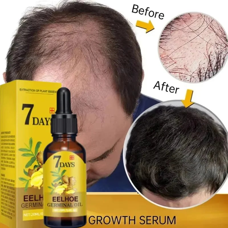 Fast Ginger Hair Growth Serum