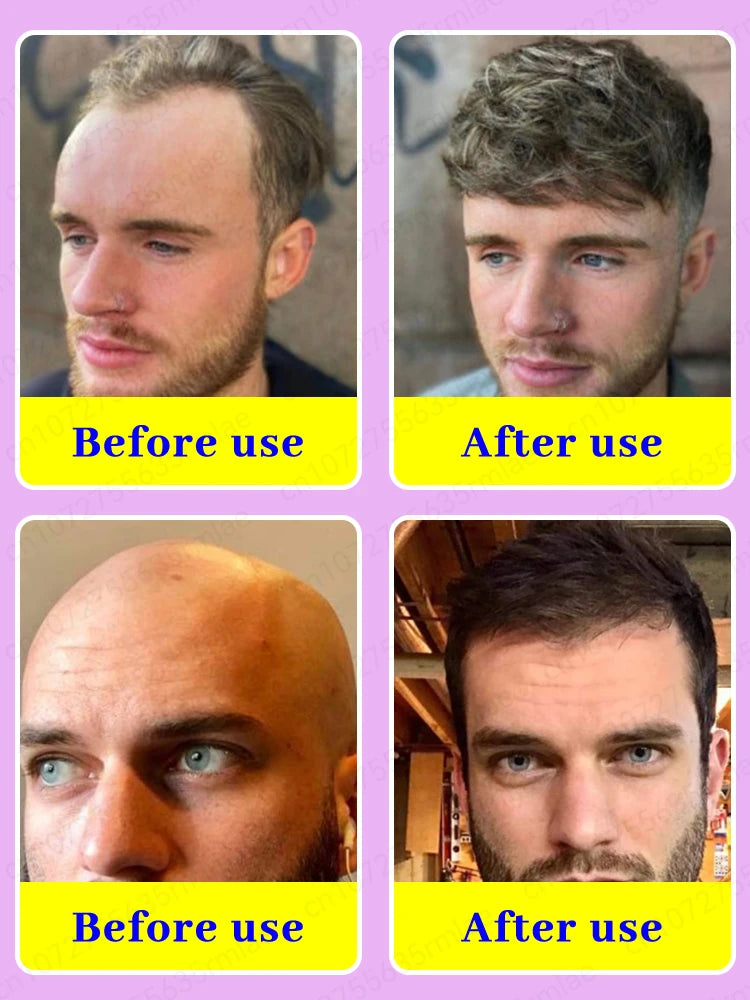 Hair growth essential oil