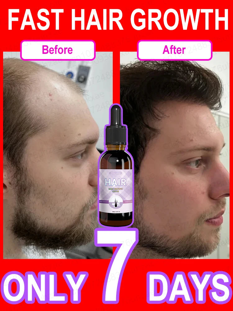 Hair growth essential oil