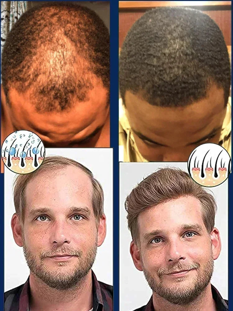 Anti Hair Loss Serum Rapid Hair Growth